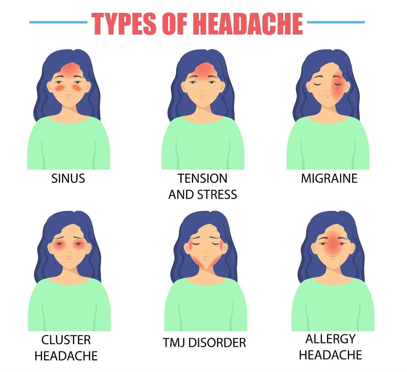 graphic displaying different types of headache pain areas on the body arnot health national migraine and headache awareness month